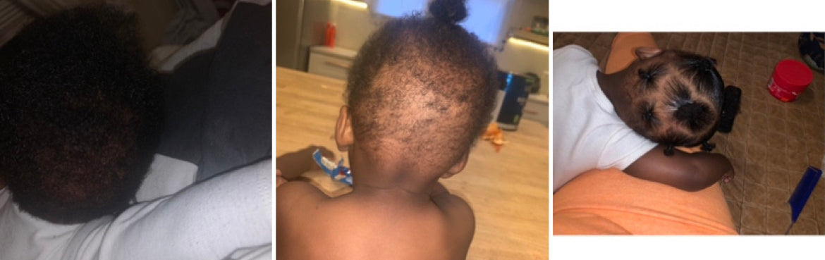Baby Hair Growth Oil