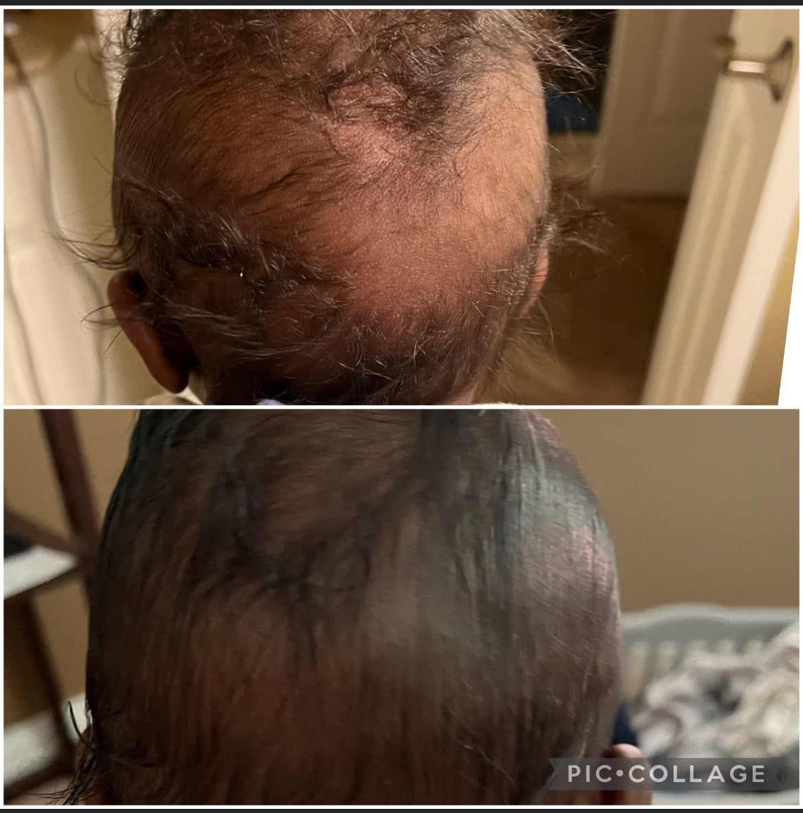 Baby Hair Growth Oil
