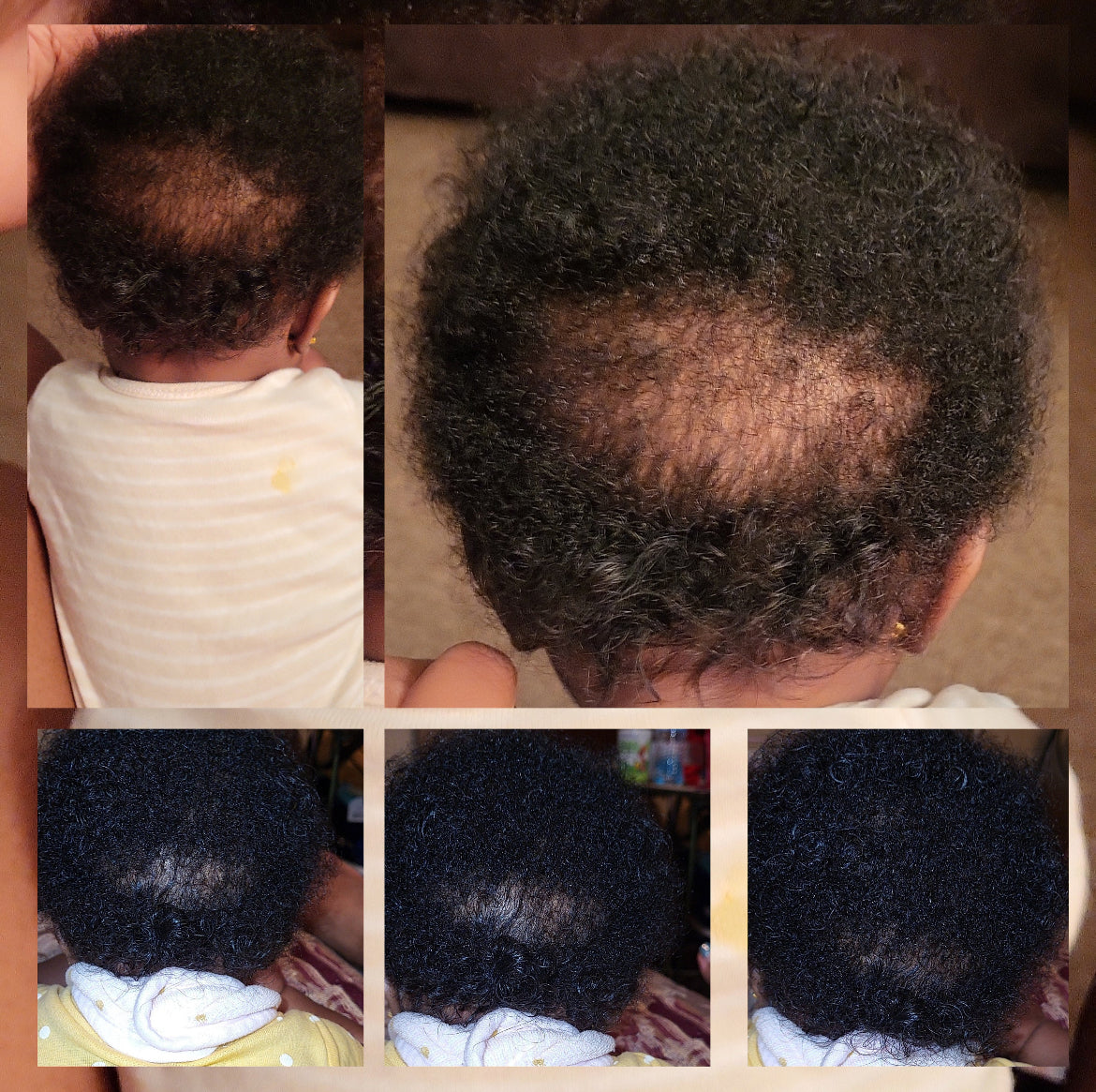 Baby Hair Growth Oil